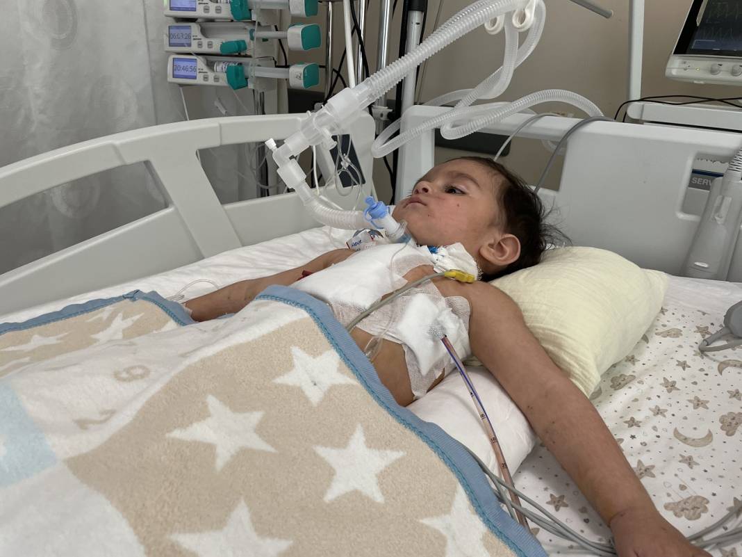 Neredeyse canından oluyordu! Konya'da bebeğin ciğerinden ceviz çıktı 1